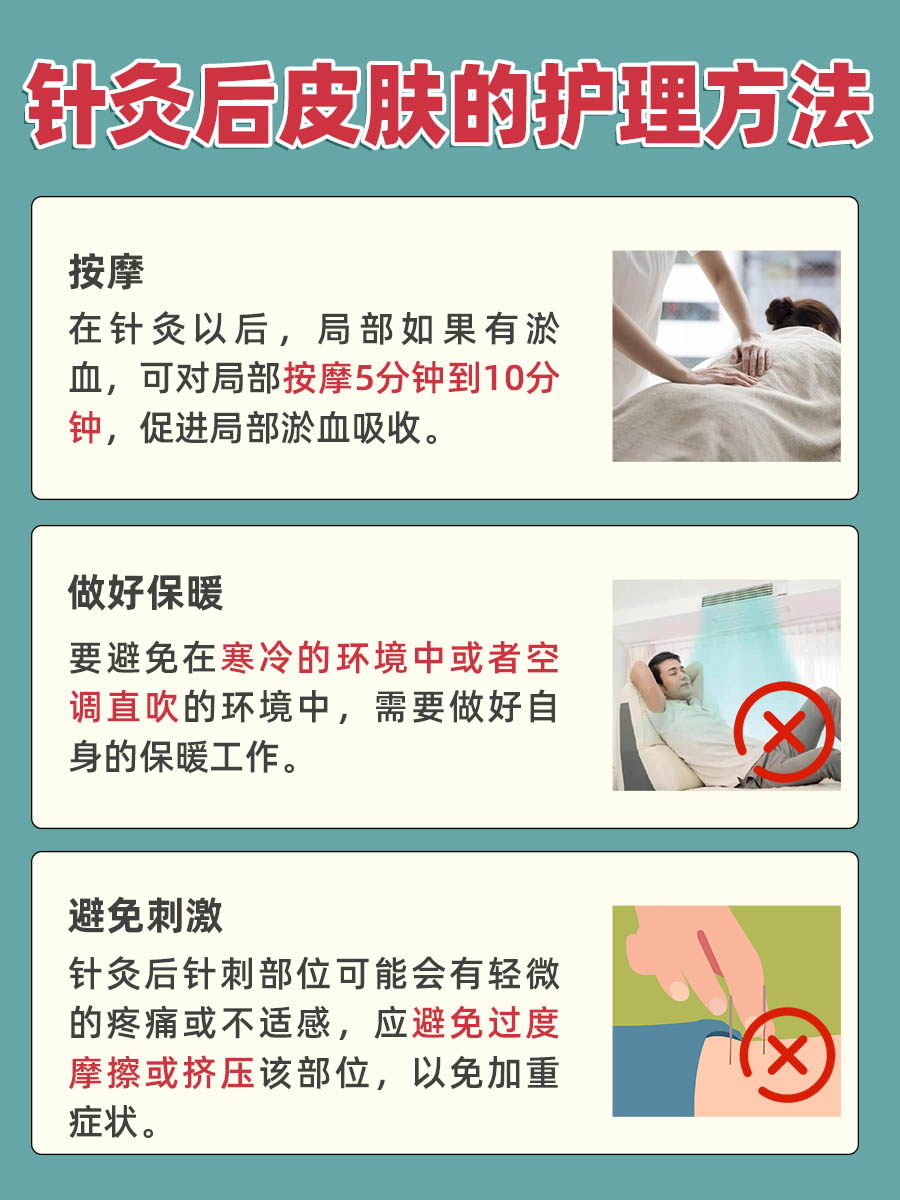 时间指南—针灸留针一般留多长时间