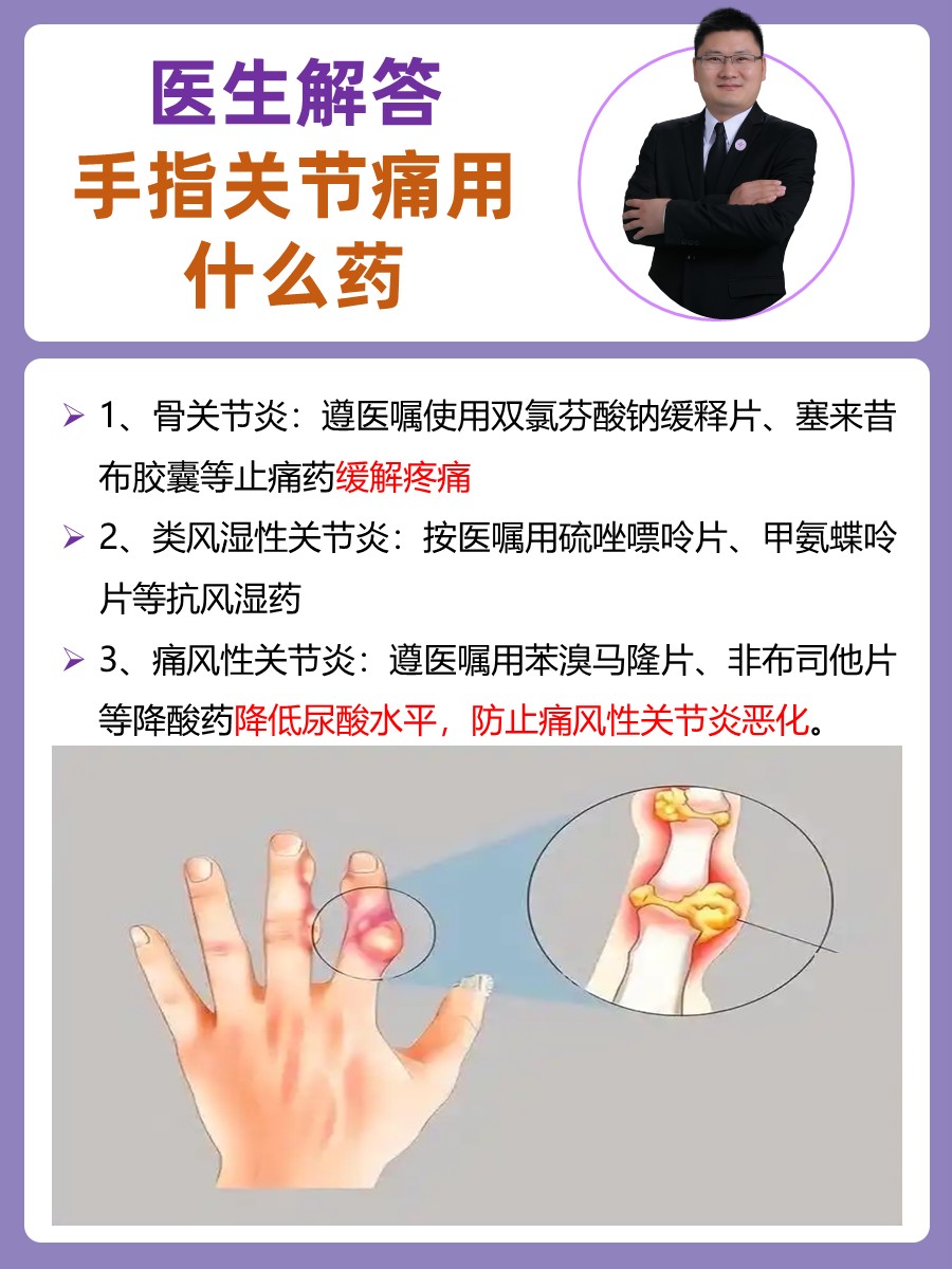 医生解答：手指关节痛用什么药