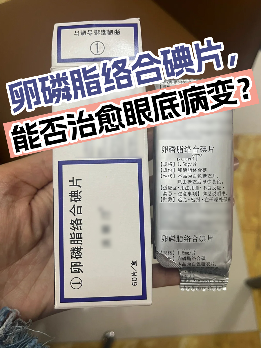 卵磷脂络合碘片，能否治愈眼底病变？