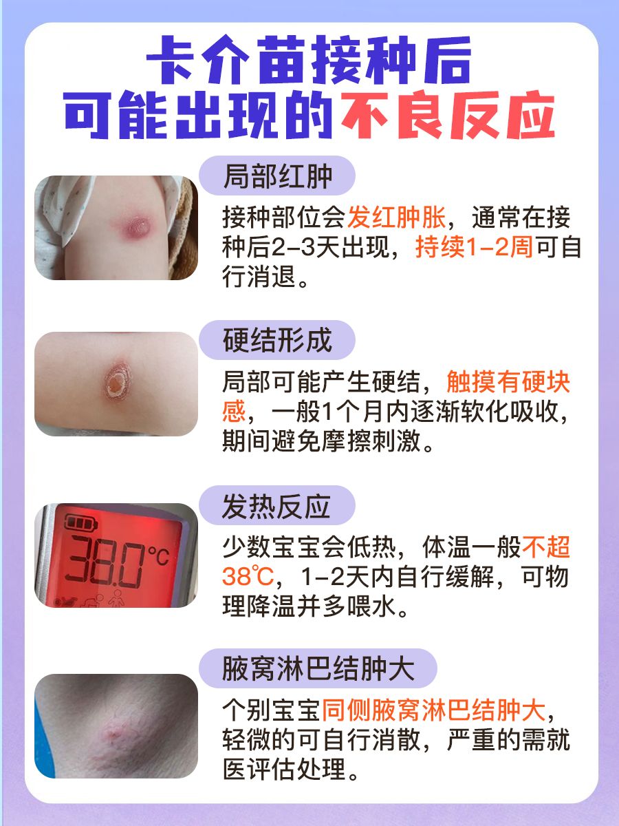 卡介苗接种后多久开始化脓？新手宝妈宝爸必知