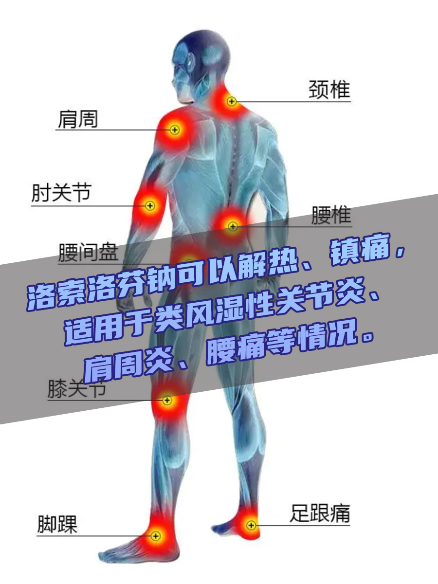 乐松——一个解热镇痛药，你了解多少？