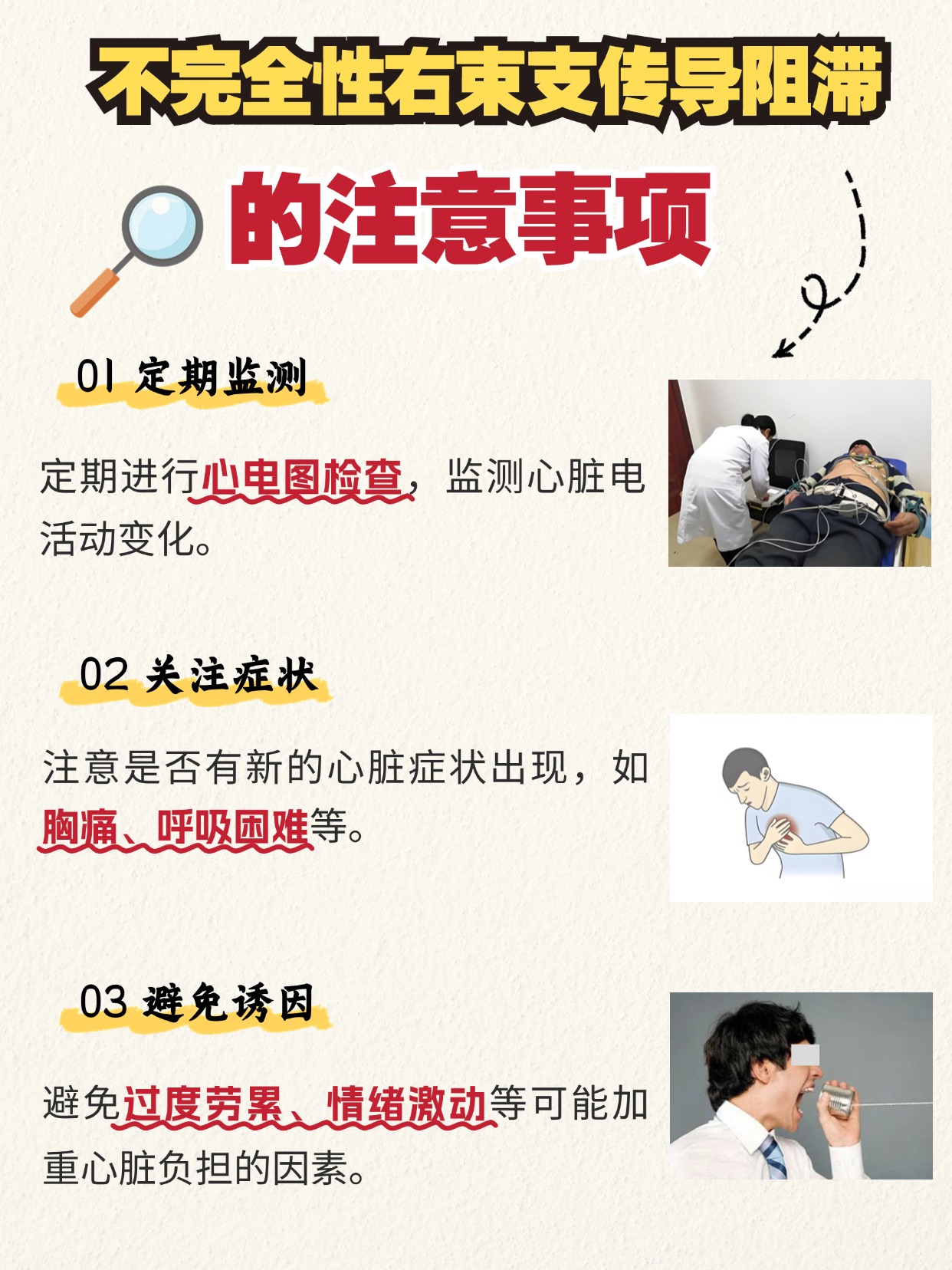 不完全性右束支传导阻滞：严重性分析
