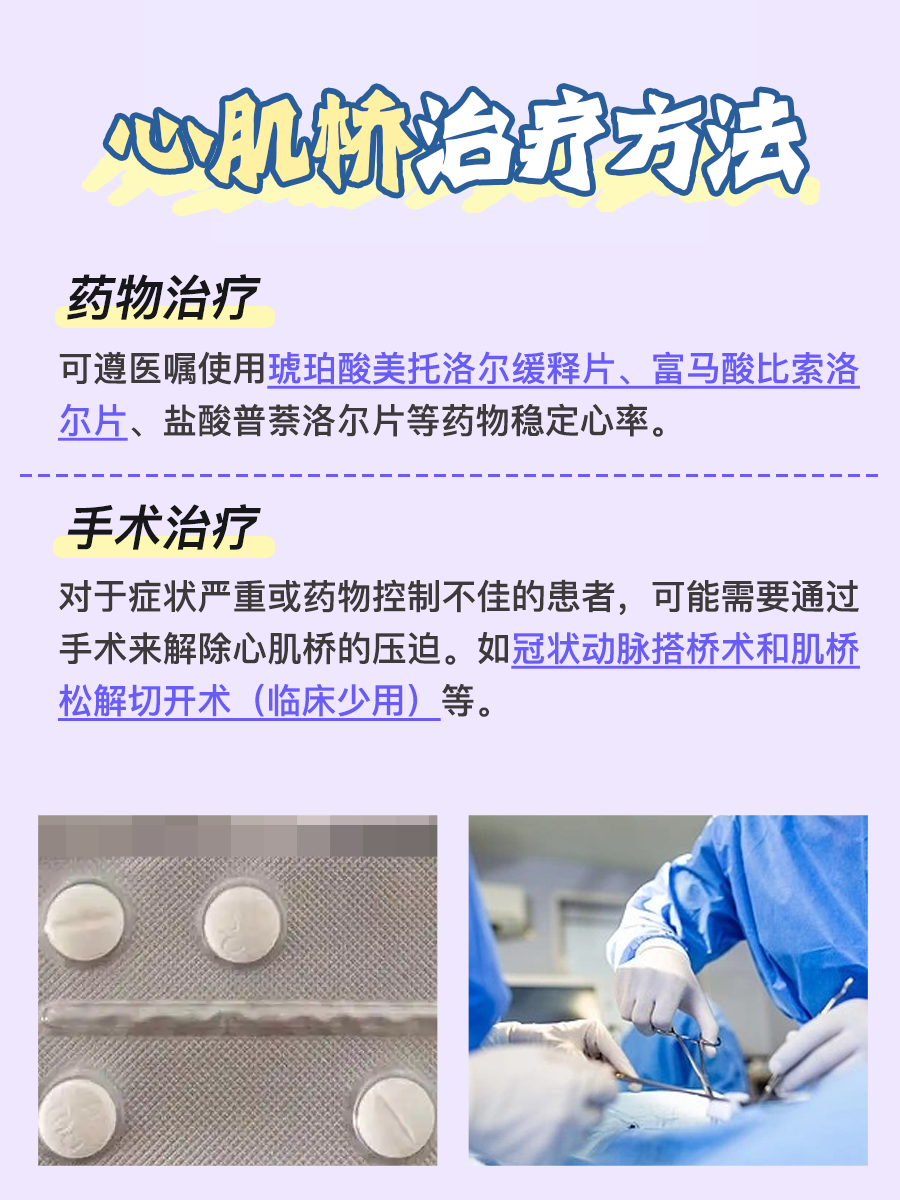 心肌桥发作时，会有哪些临床表现？