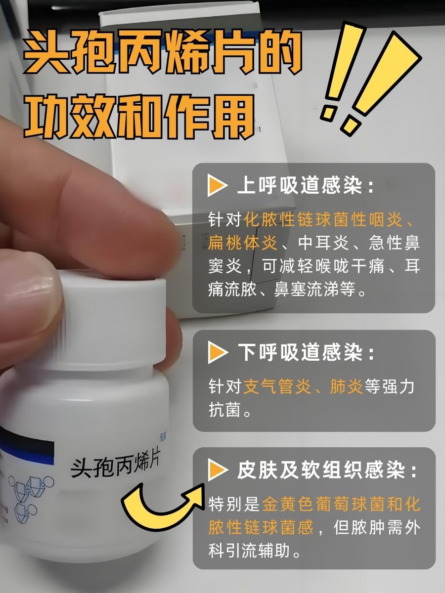 别再乱用药！头孢丙烯片的功效作用你清楚吗？