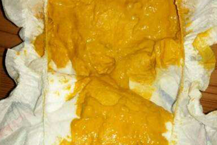 金黄色大便图 金黄色大便图