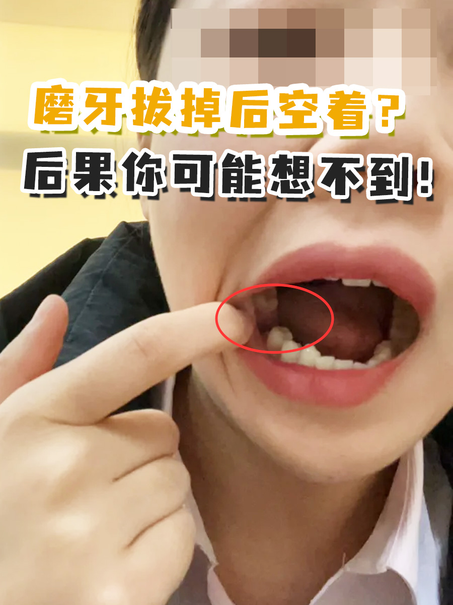 磨牙拔掉空着？后果你可能想不到！