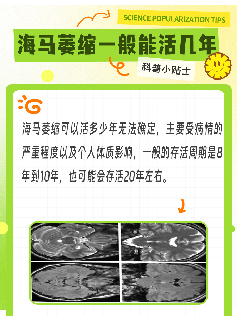 海马萎缩患者的生存预期：究竟能活多少年？