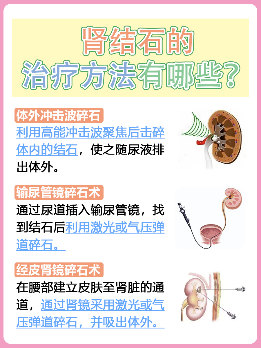 有肾结石的人能吃什么、不能吃什么?医生揭晓