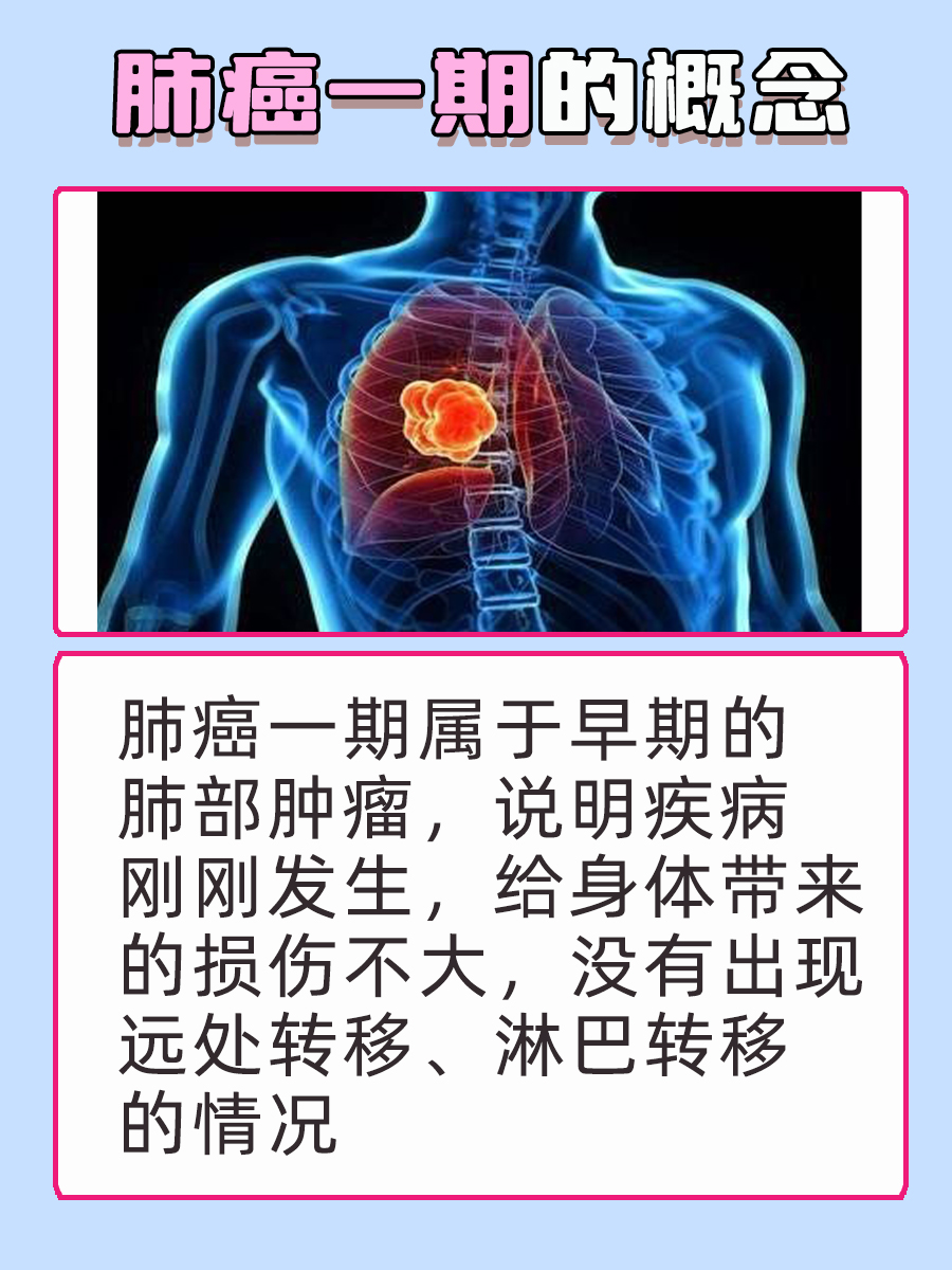 揭秘!肺癌一期是什么概念