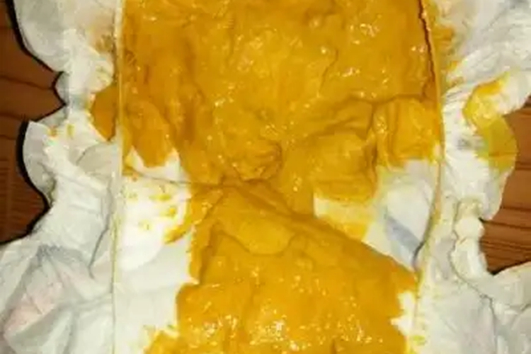 黄糊状大便图