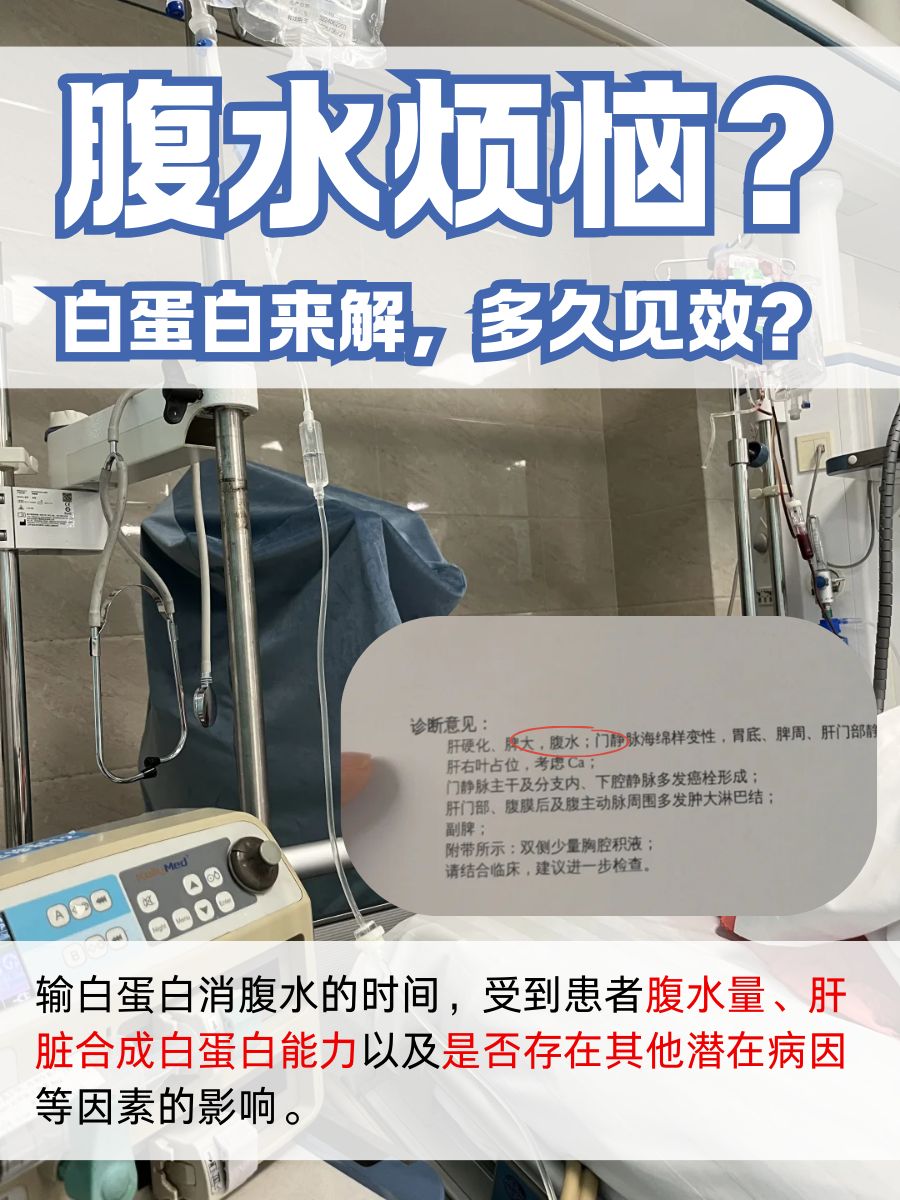 腹水烦恼？白蛋白来解，多久见效？