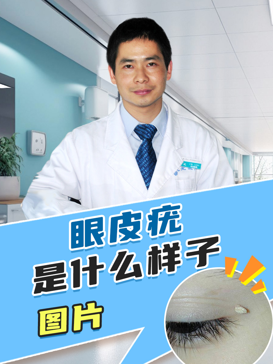 眼皮疣是什么样子图片