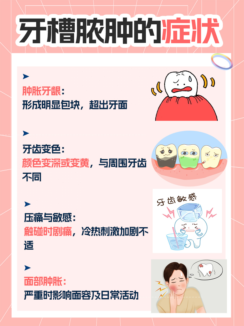 高清图解！牙槽脓肿长啥样？一文带你认清它！