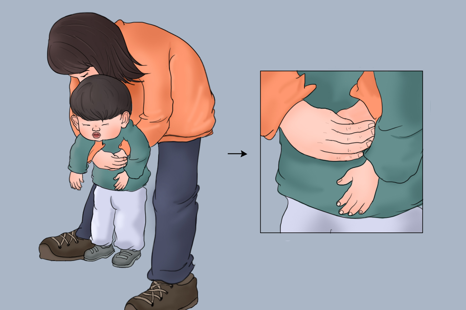 仿成人海姆立克急救法 仿成人海姆立克急救法