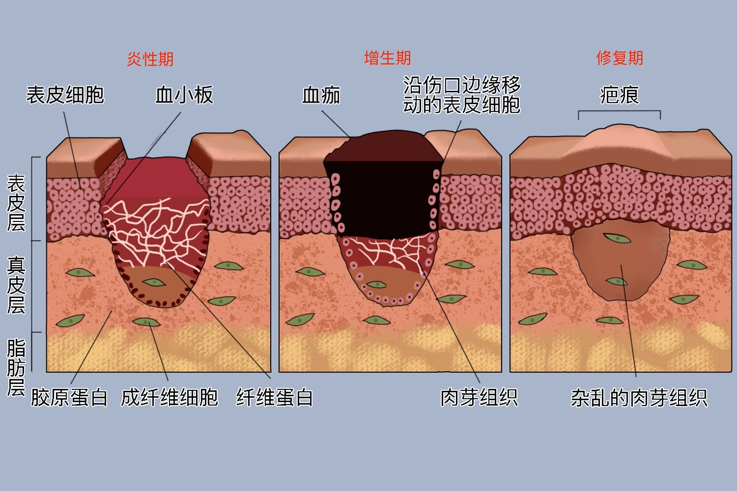 伤口愈合过程图