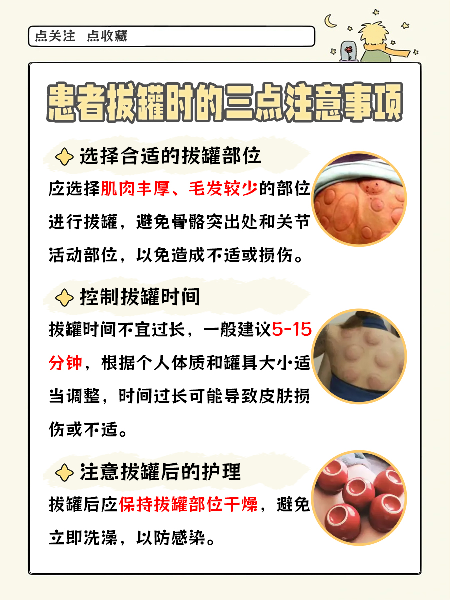 人体拔罐的12个位置图