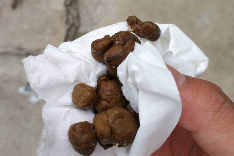 正常深褐色大便图