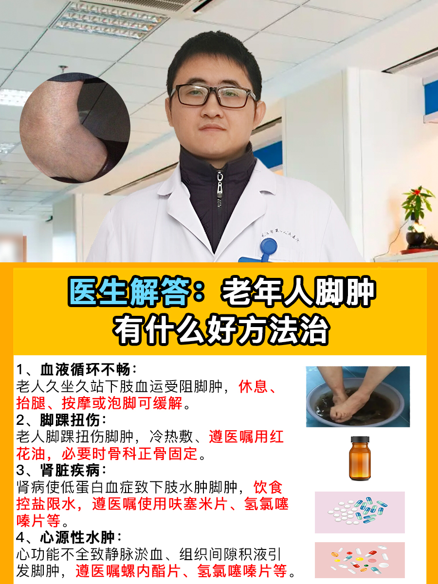 医生解答：老年人脚肿有什么好方法治