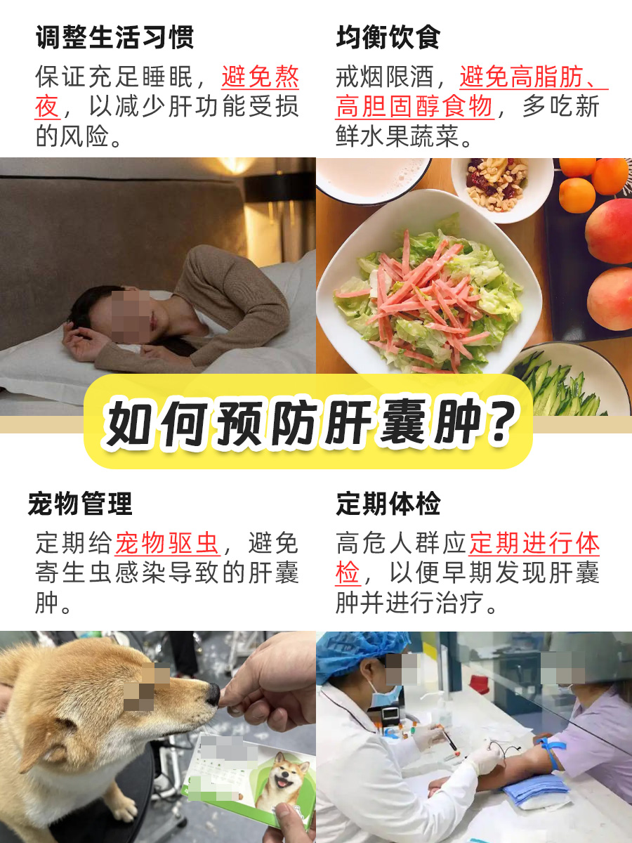 不可忽视!脂肪肝VS肝囊肿,哪个更严重?