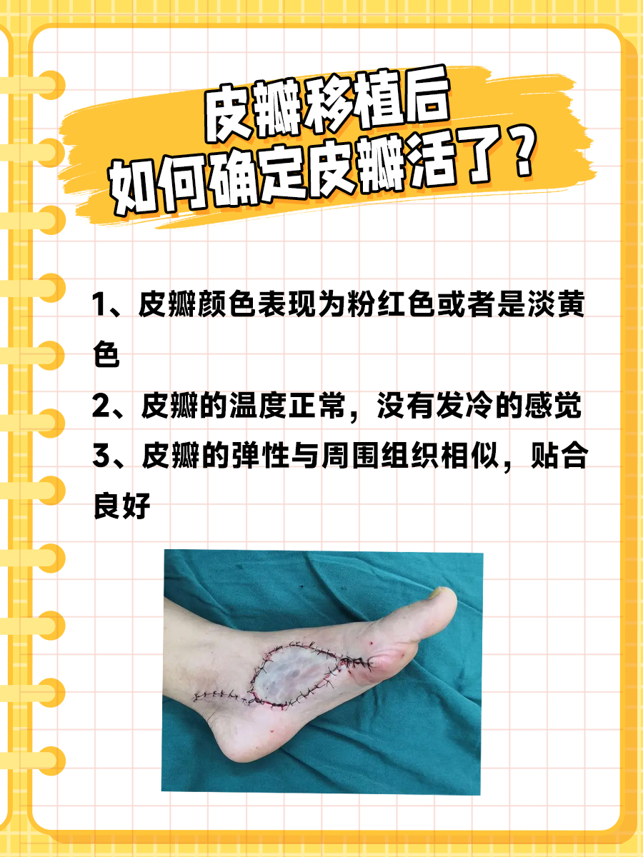 皮瓣移植大揭秘:究竟多久能“起死回生”?