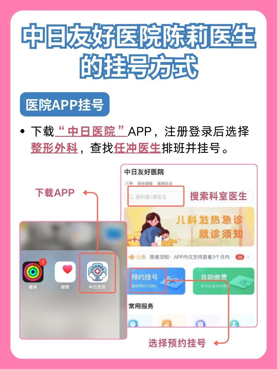 中日友好医院任冲医生怎么样？怎么挂号？