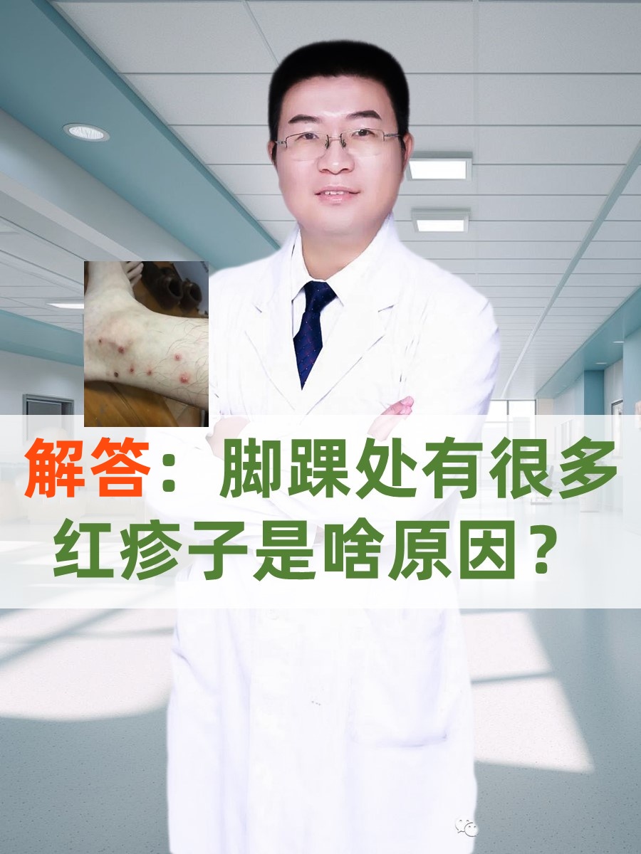 解答：脚踝处有很多红疹子是啥原因？
