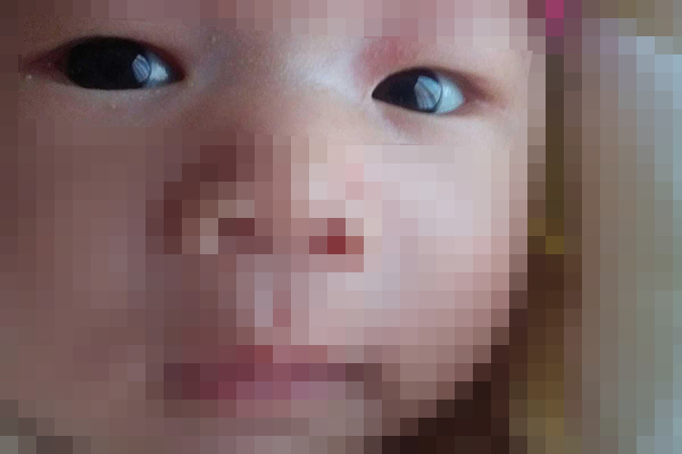 新生儿正常瞳孔图