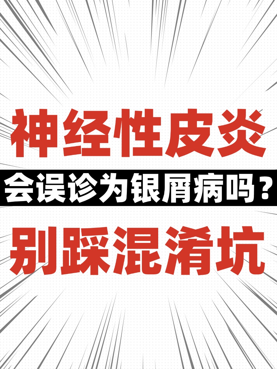 神经性皮炎会误诊为银屑病吗？别踩混淆坑
