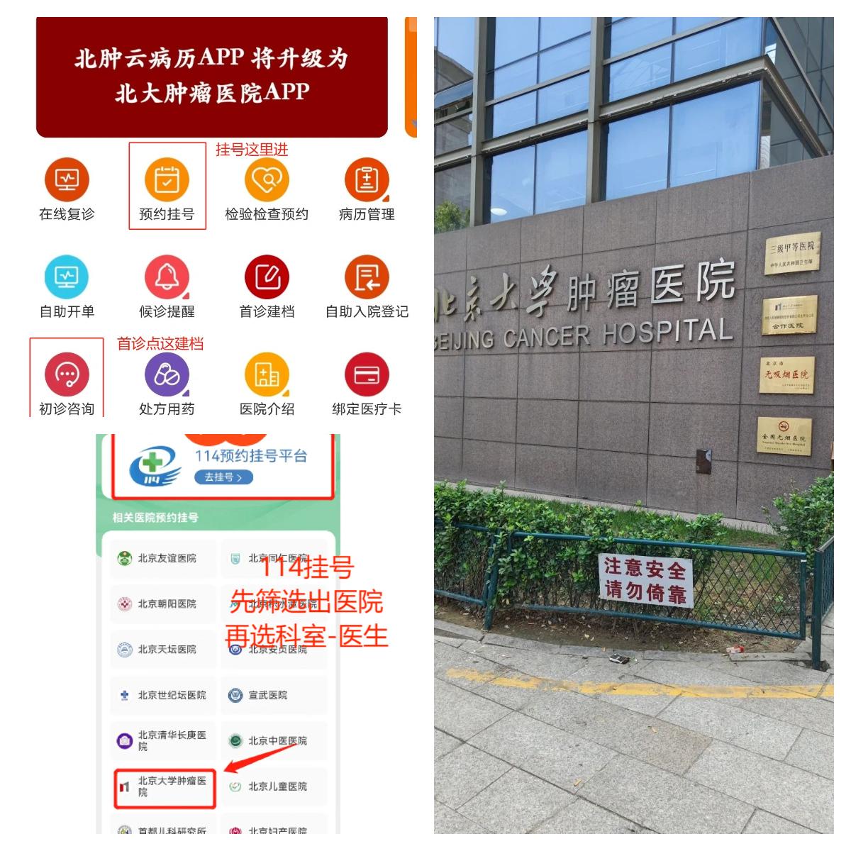 北大肿瘤医院朱旭大夫怎么样？怎么挂号？