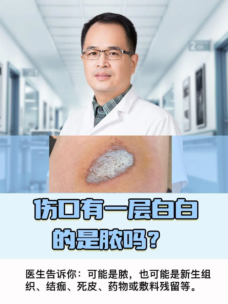 伤口有一层白白的是脓吗？医生告诉你