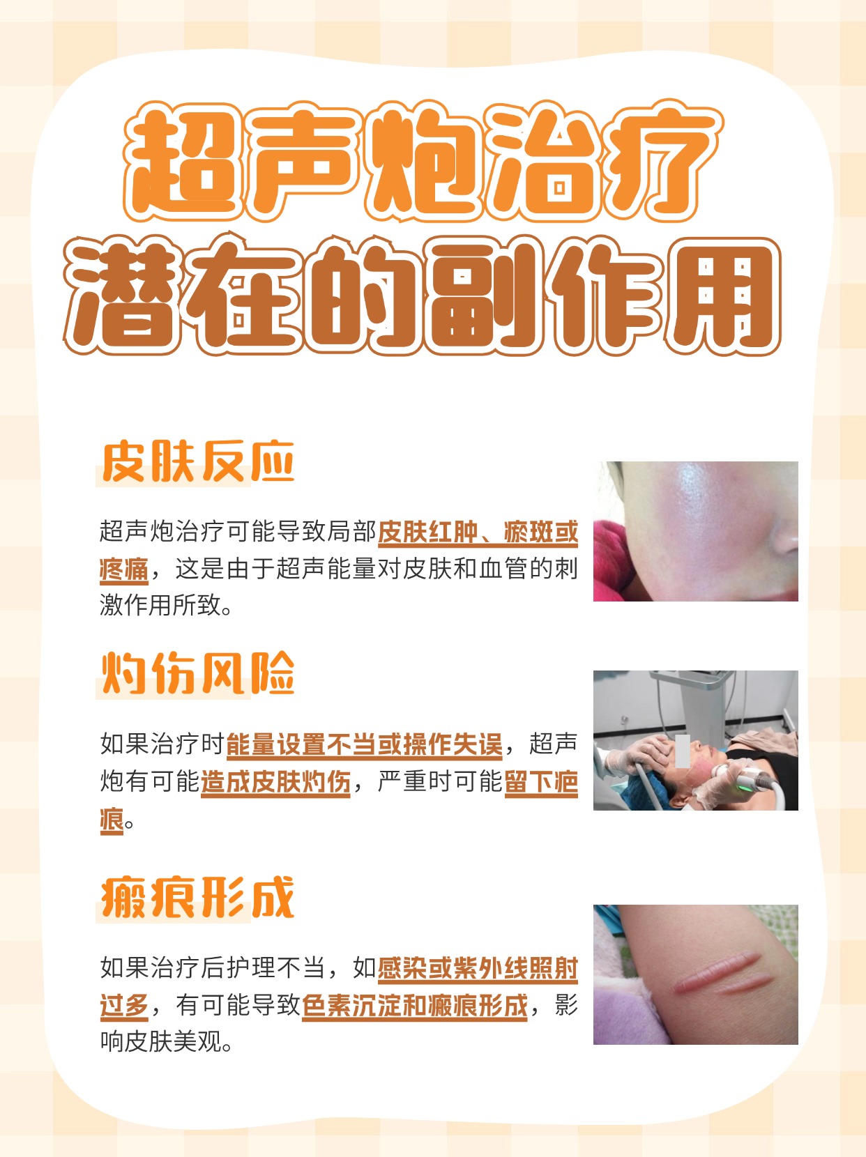 超声炮治疗后多久效果比较好?一文解答!