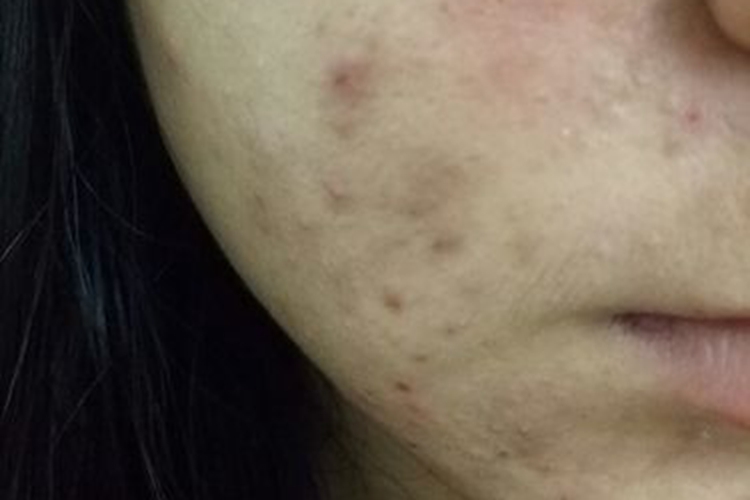 面部血虚风燥图