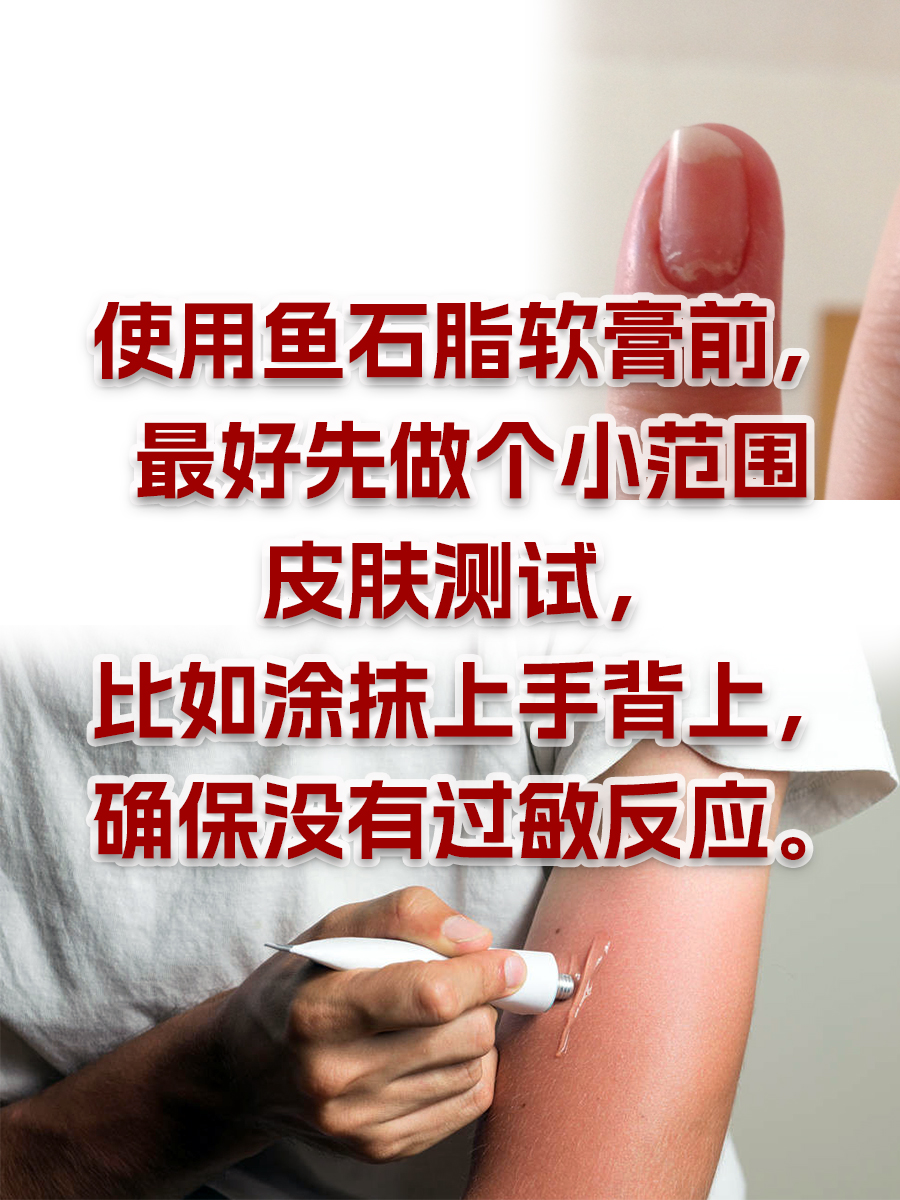 亲身经历：鱼石脂软膏拔脓