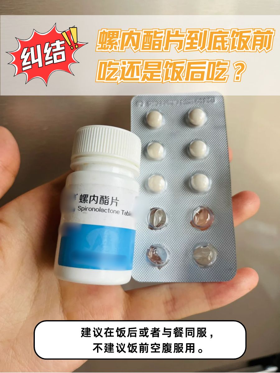 纠结！螺内酯片到底饭前吃还是饭后吃？