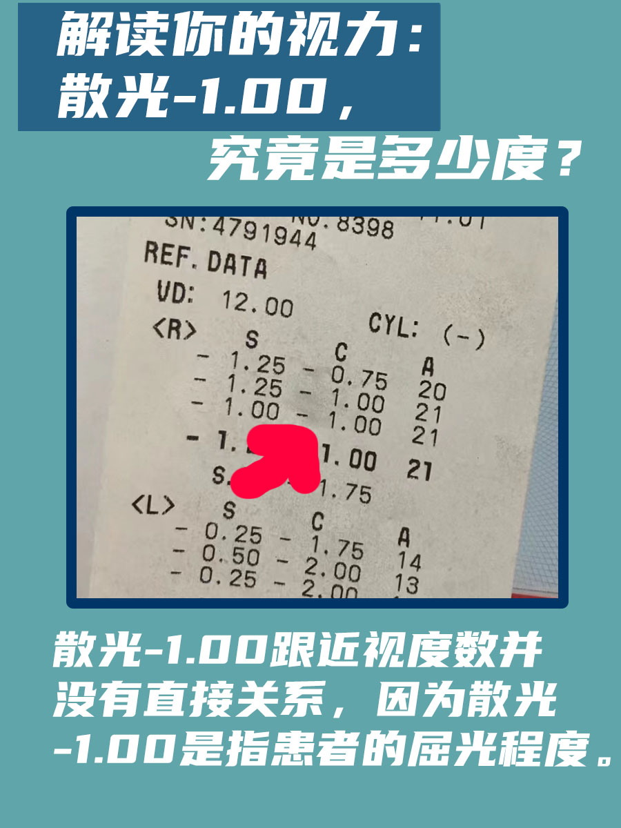 解读你的视力：散光-1.00，究竟是多少度？