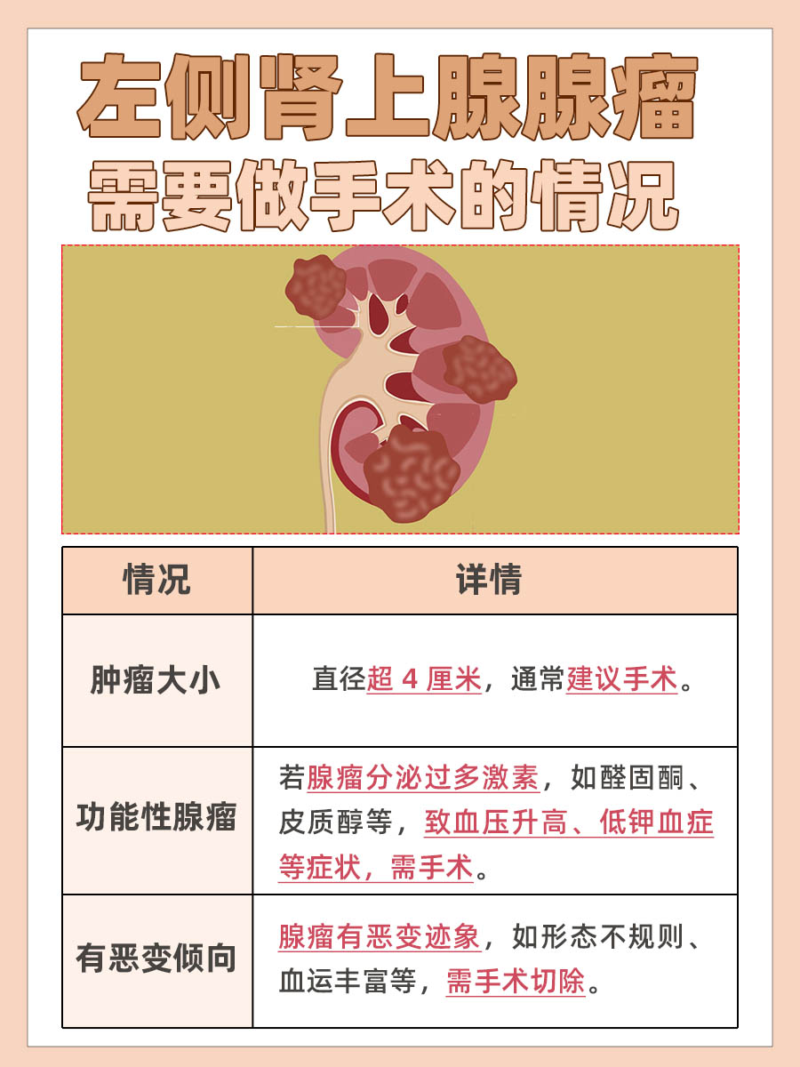 左侧肾上腺腺瘤需要做手术吗？真相大揭秘