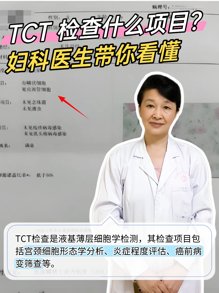 TCT 检查什么项目?妇科医生带你看懂