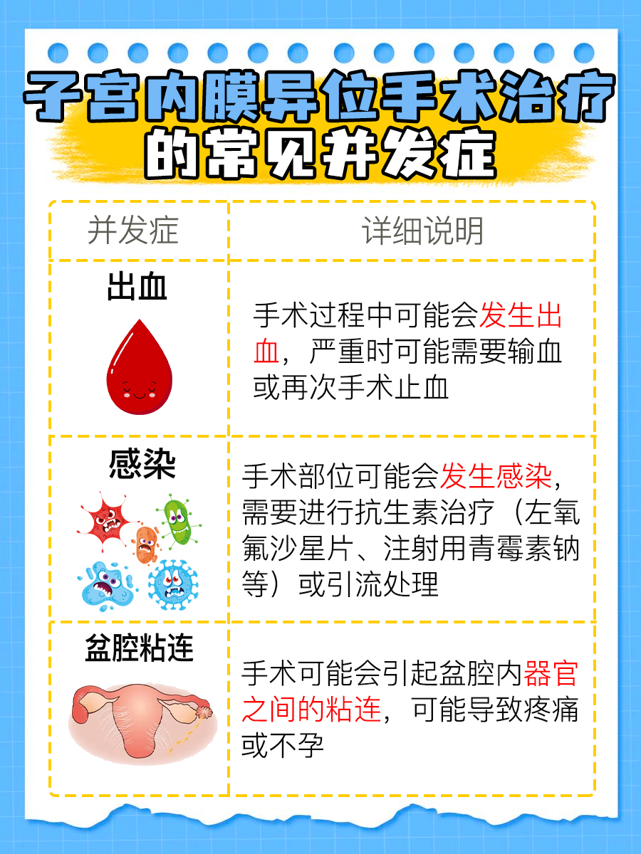 子宫内膜异位症：各期特征分析