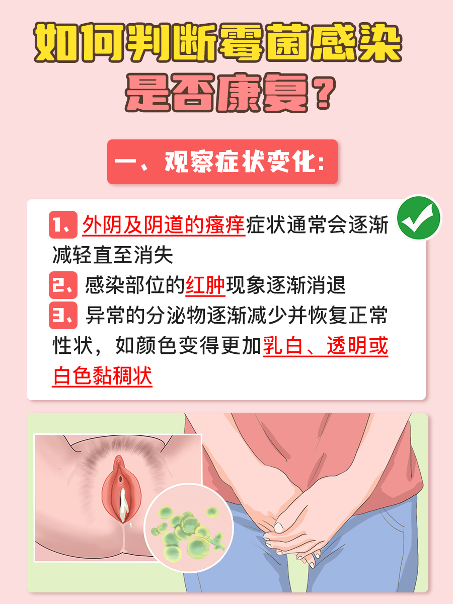 霉菌感染用药日记：一周不痒，停药？NO！