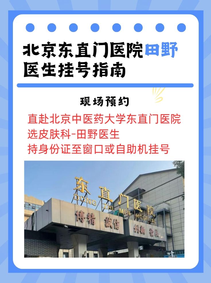 北京东直门医院田野医生怎么样？怎么挂号？