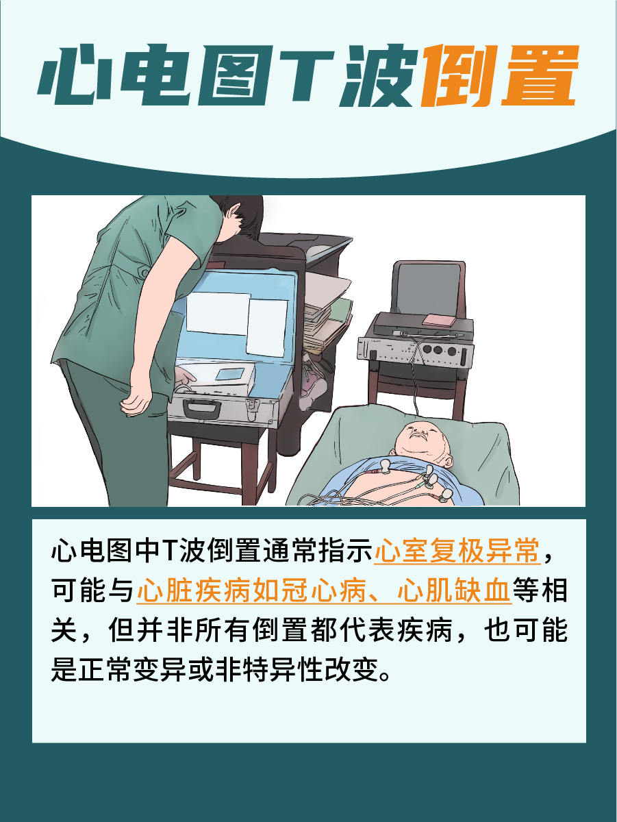 带你了解，心电图T波倒置是什么意思