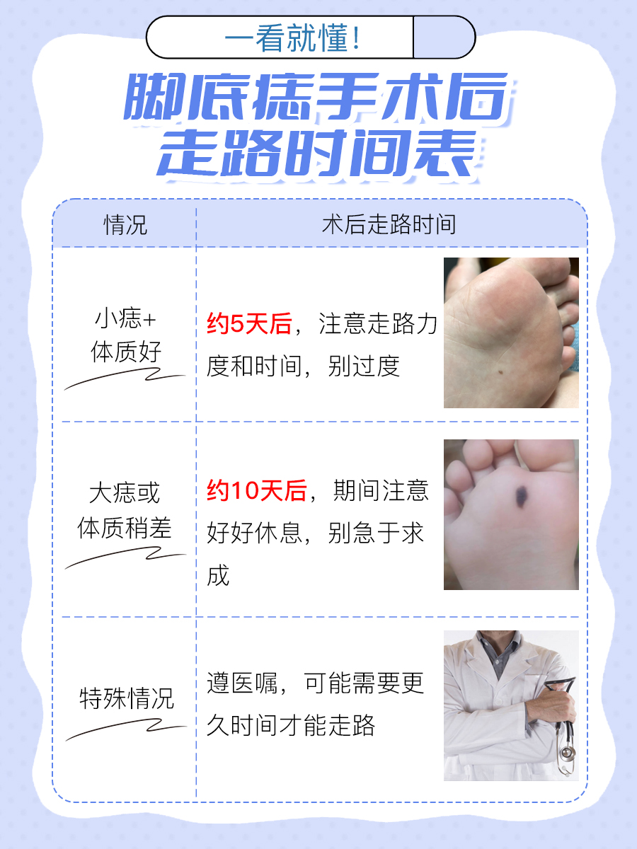 脚底痣手术后的康复之路：走路时间知多少？