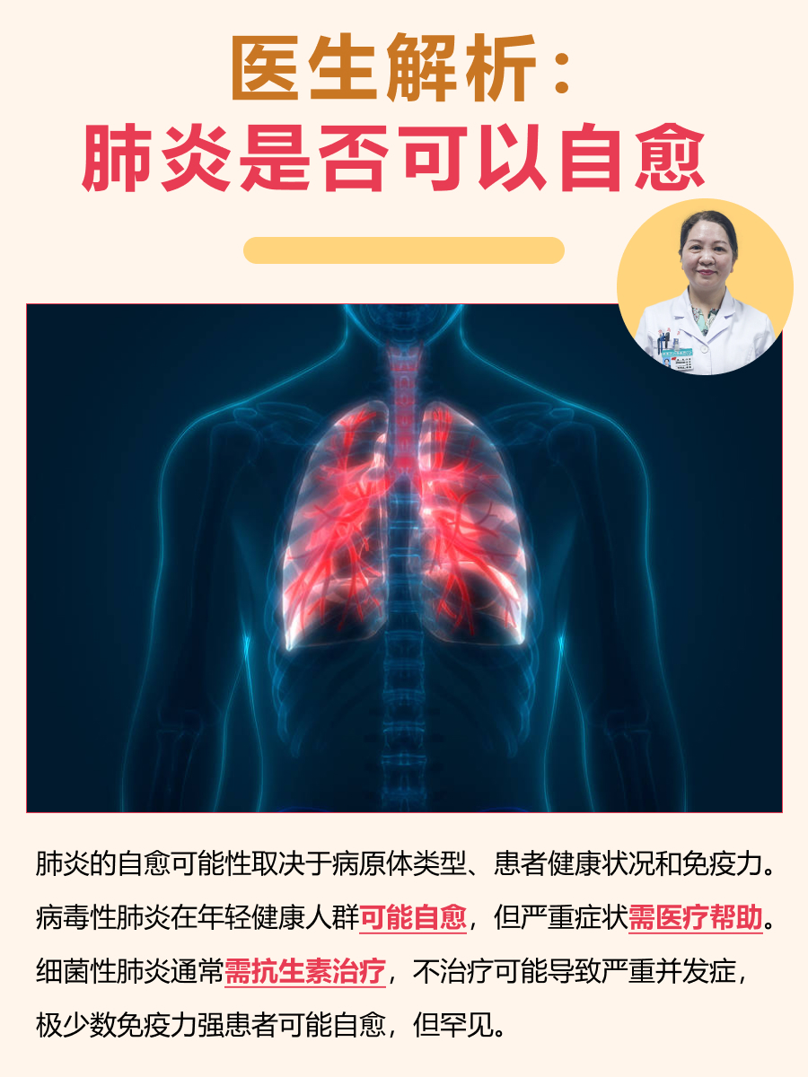 医生解析：肺炎是否可以自愈