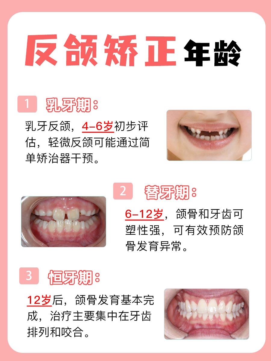 反颌矫正黄金期：把握最佳年龄，改变一生！