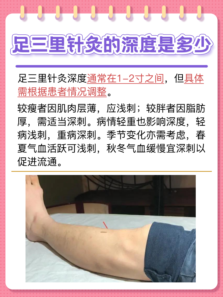 针灸足三里，深度你了解吗？速来围观