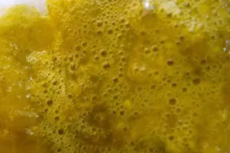 水样大便图 水样大便图