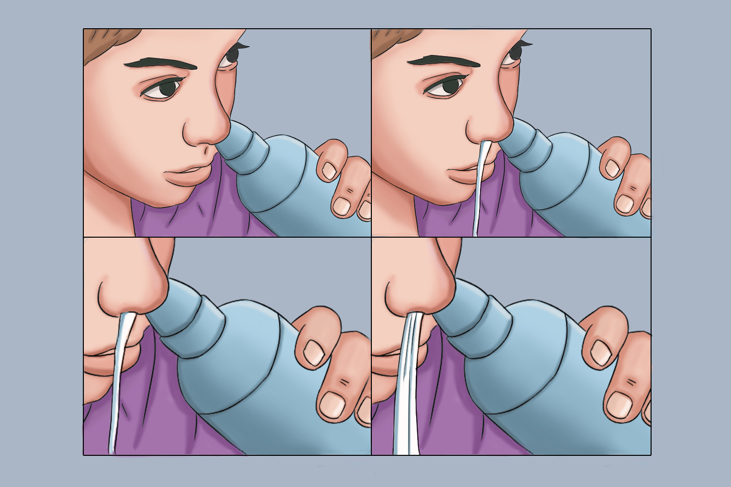 鼻腔冲洗过程图