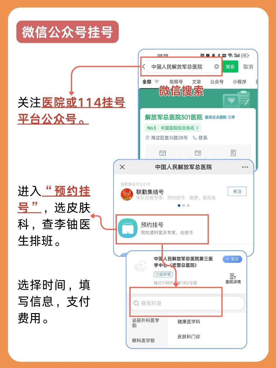 空军总医院李铀医生怎么样？怎么挂号？