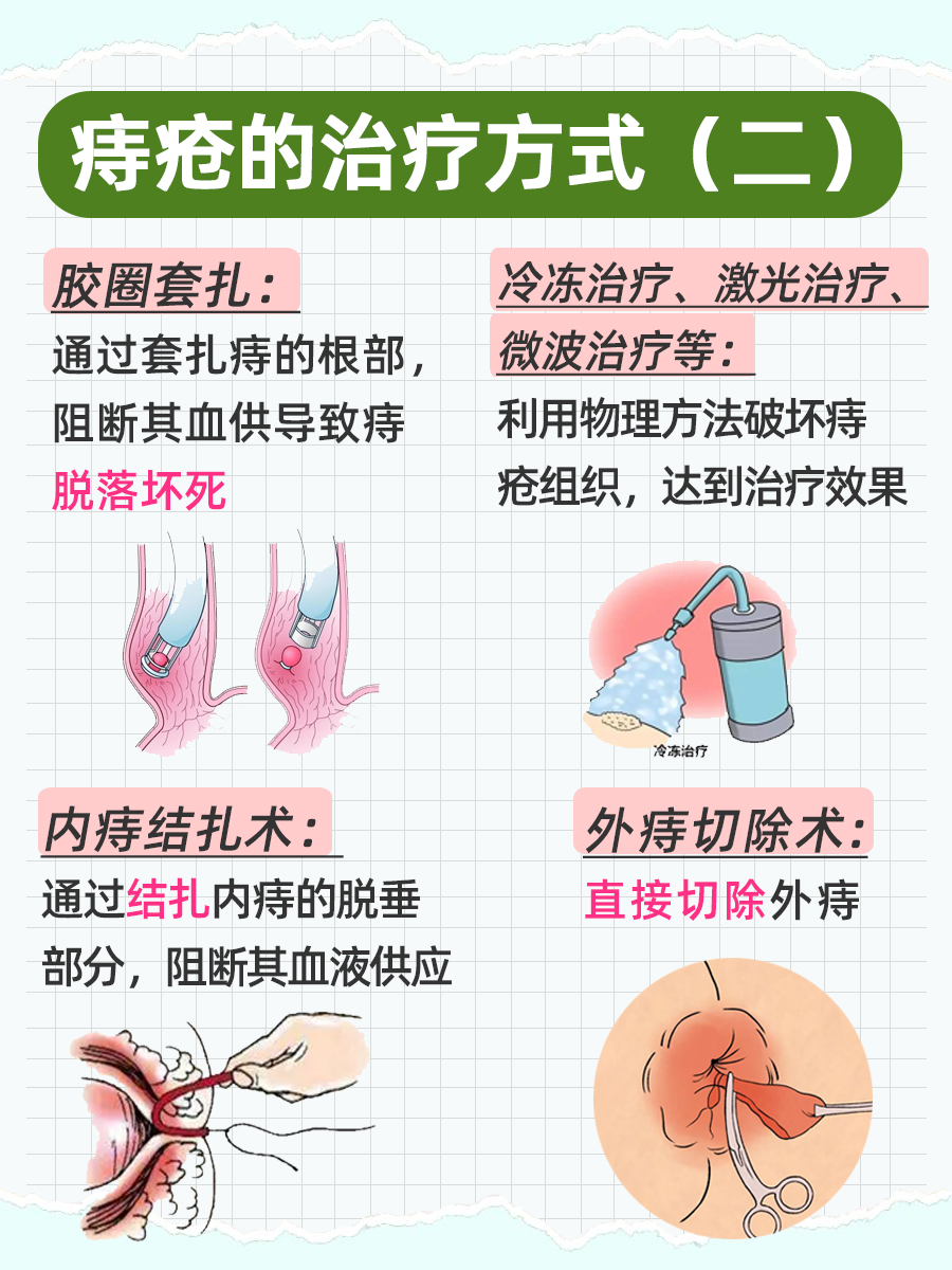 36个治痔疮偏方？一文了解