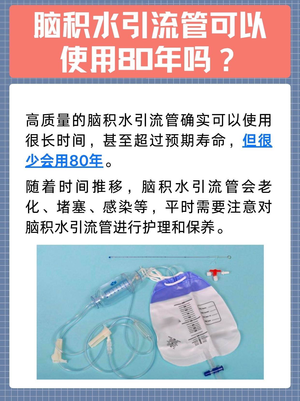 脑积水引流管使用80年:真实还是噱头?